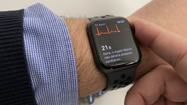 Apple Watch: Lekár našiel riešenie na vykonanie „kompletného elektrokardiogramu“ 256
