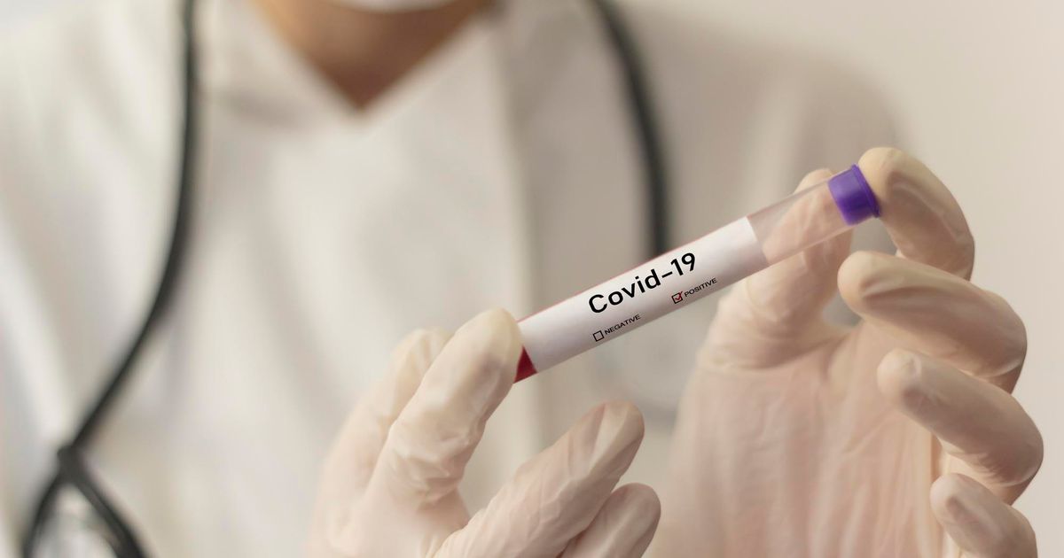 Štúdia varuje, že koronavírus môže byť nákazlivý ešte skôr, ako sa objavia príznaky 89