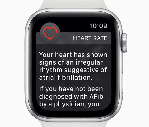Prečo sú niektorí lekári znepokojení Apple Watchfunkcia EKG