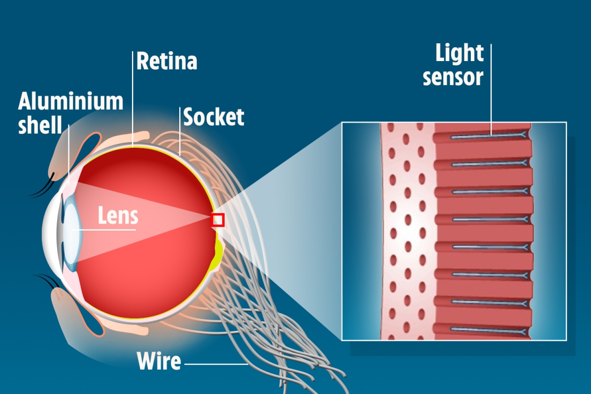 Vedci odhalili bionické oko, ktoré vám poskytne Nočnú víziu a má 46 -krát viac „buniek“ ako ľudské oko 1